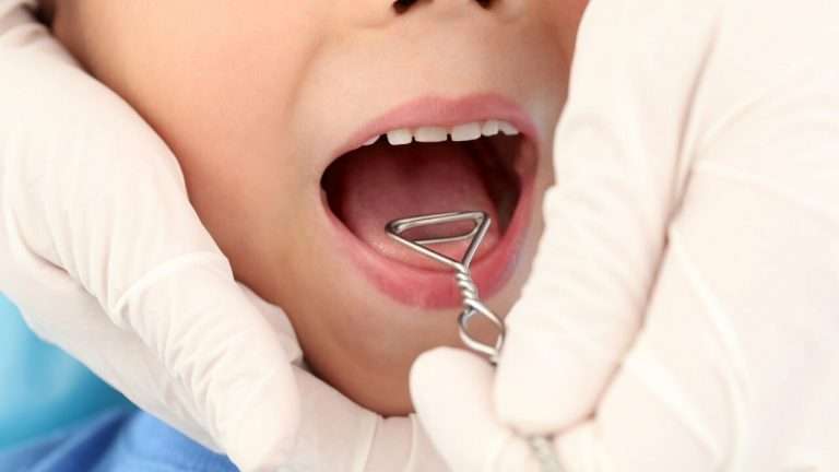 ortodontista e logopedista